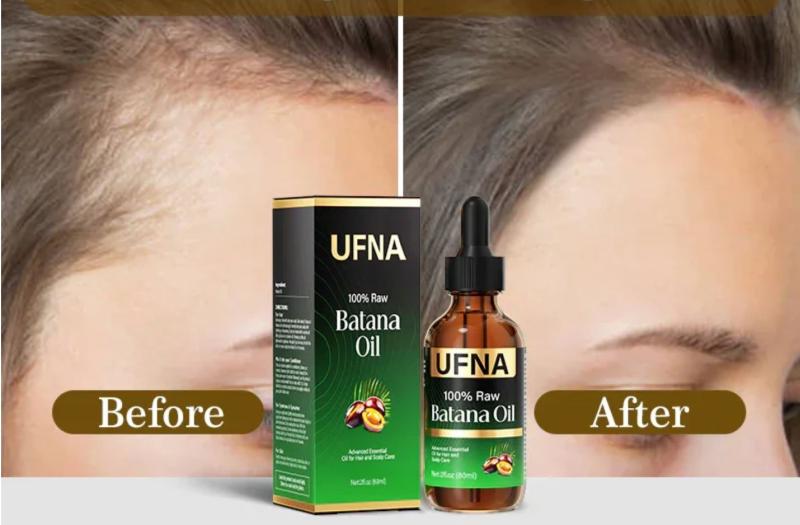 https://whitelabel-manager-production.ams3.digitaloceanspaces.com/thumbs/screenshot-of-ufna-batana-oil-product-page-at-snidin-website-displaying-the-product-image-with-before-and-after-claims-70a5a.jpg_800x.jpg
